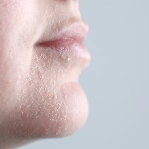 Are Microplastics in Your Skincare?