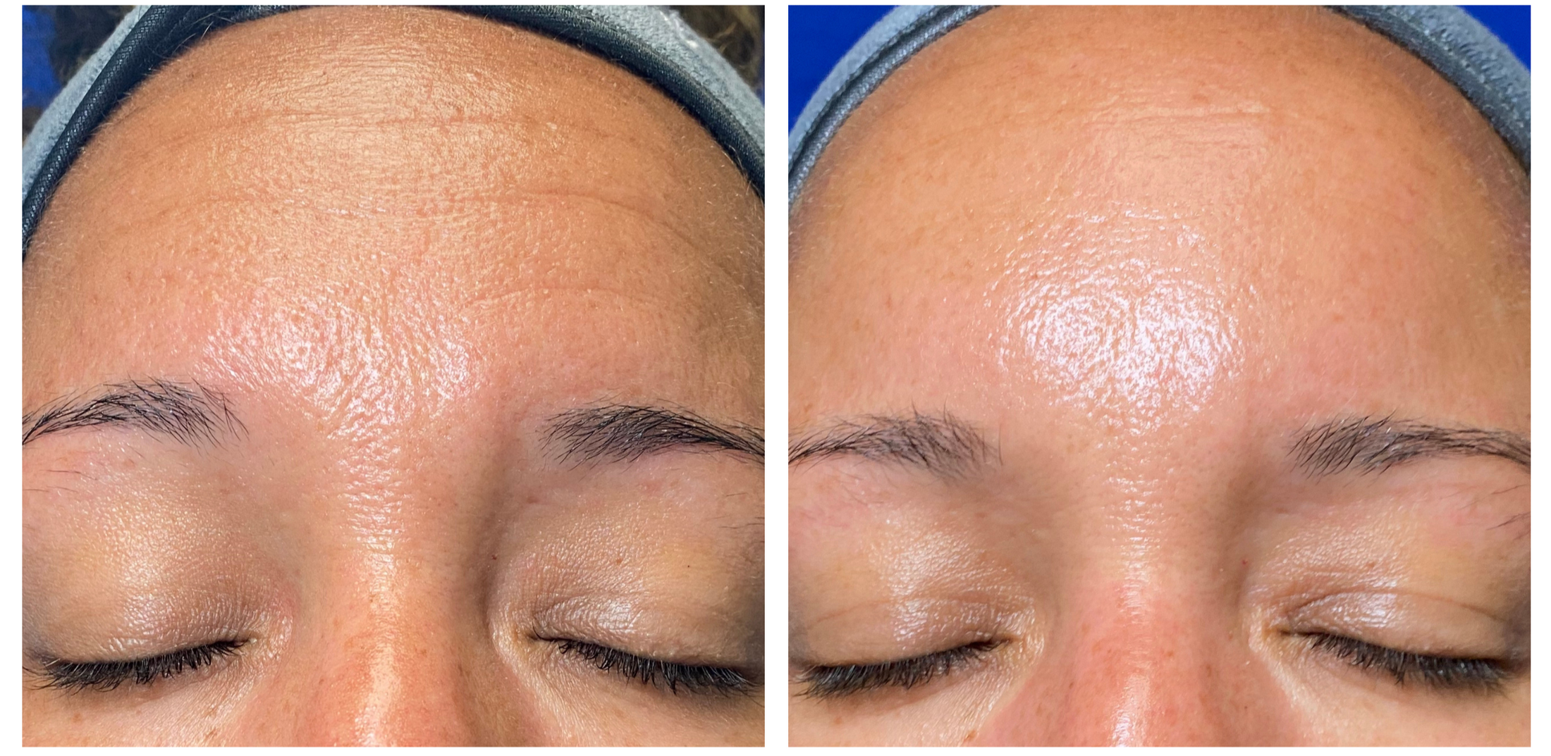 SHED THE DEAD! Peel package!