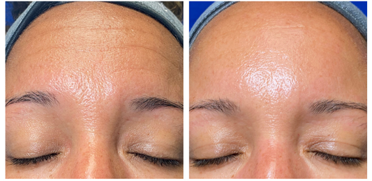 SHED THE DEAD! Peel package!