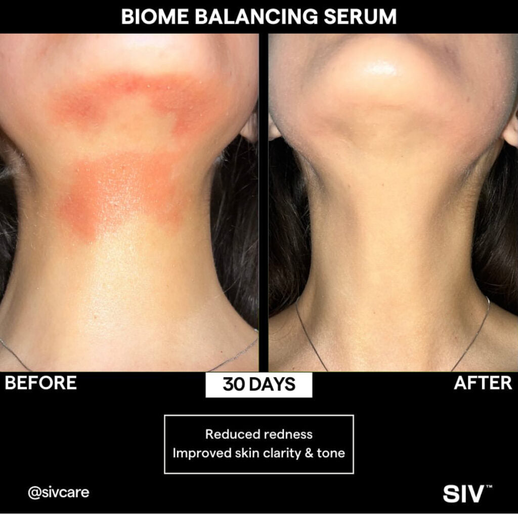 Biome Balancing Serum - SIV