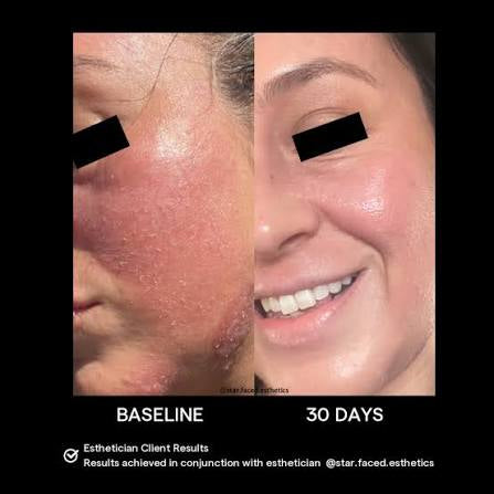 Biome Balancing Serum - SIV