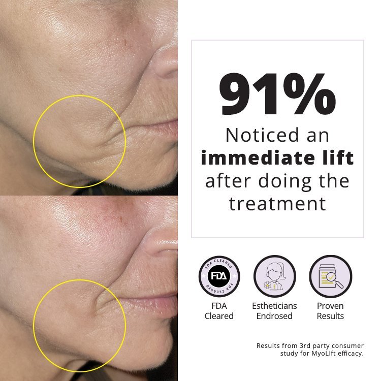 MyoLift™ QT Plus Facial Toning Device
