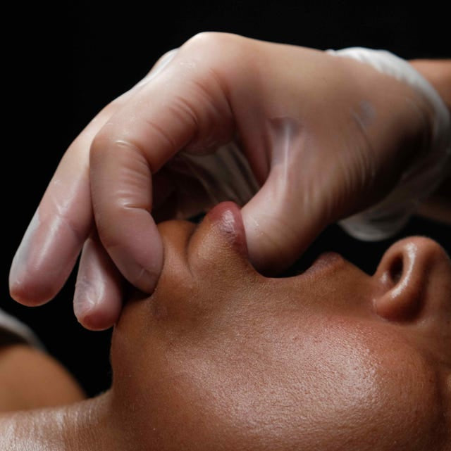 What Is Buccal Facial Massage?
