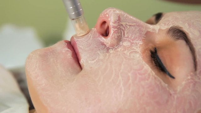 Meet our Nano Needling Treatments