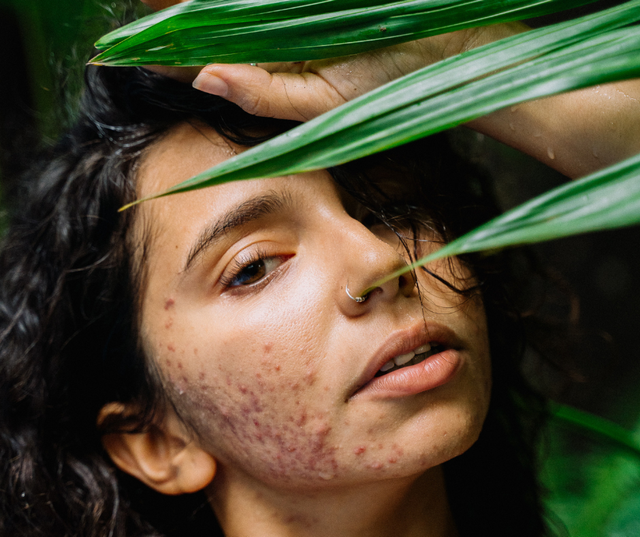 What Humidity Does to Our Skin