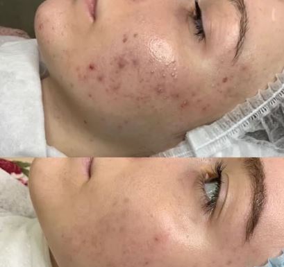 SPA PACKAGE DEALS