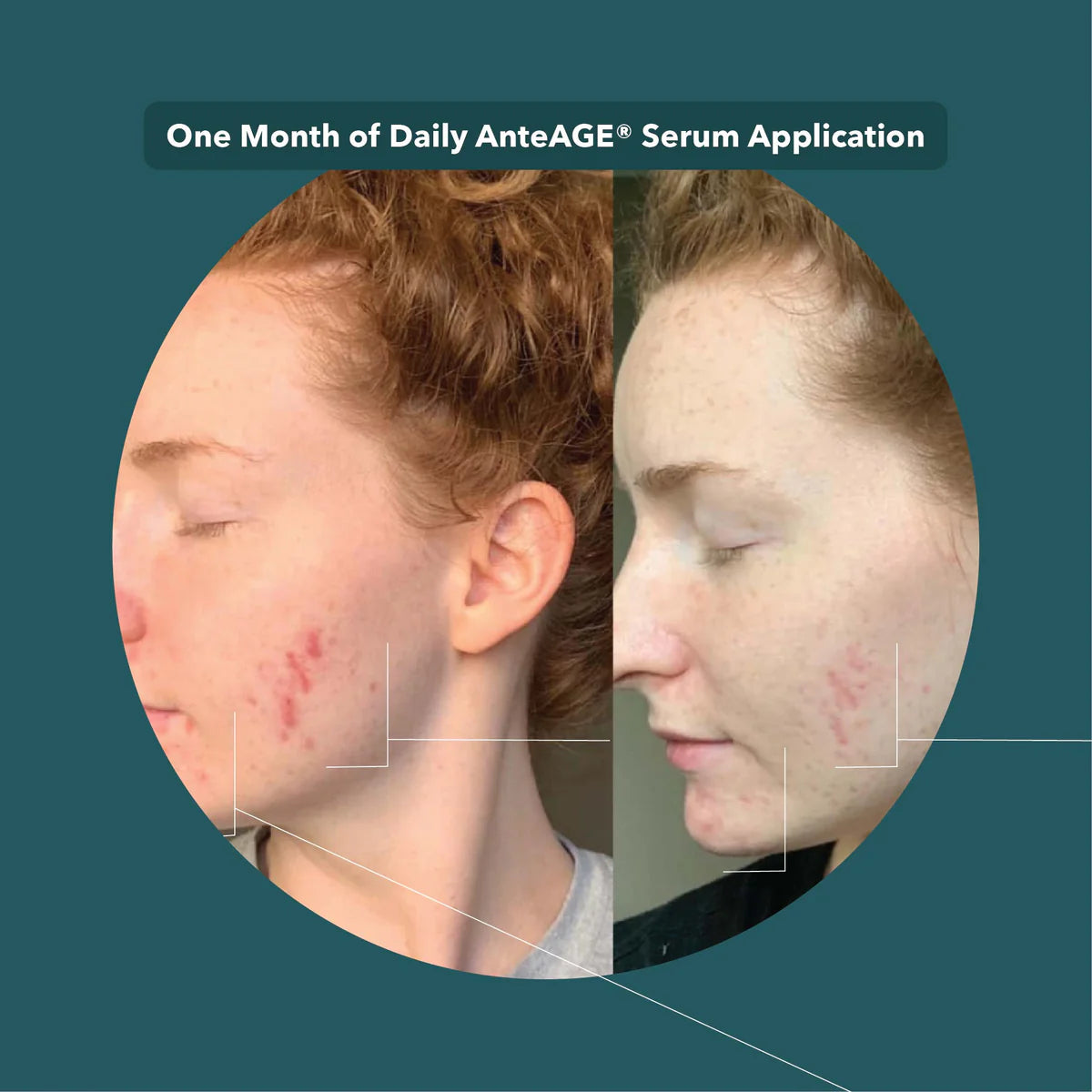 AnteAGE GF Serum