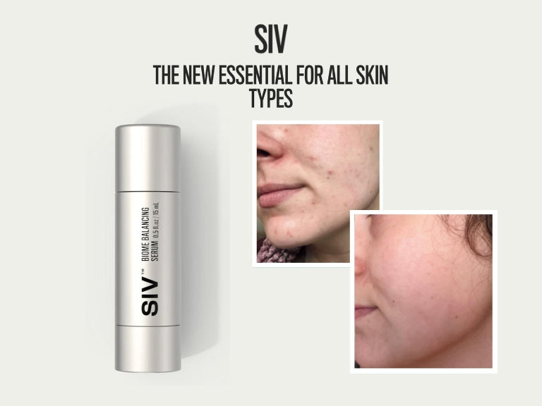 Biome Balancing Serum - SIV
